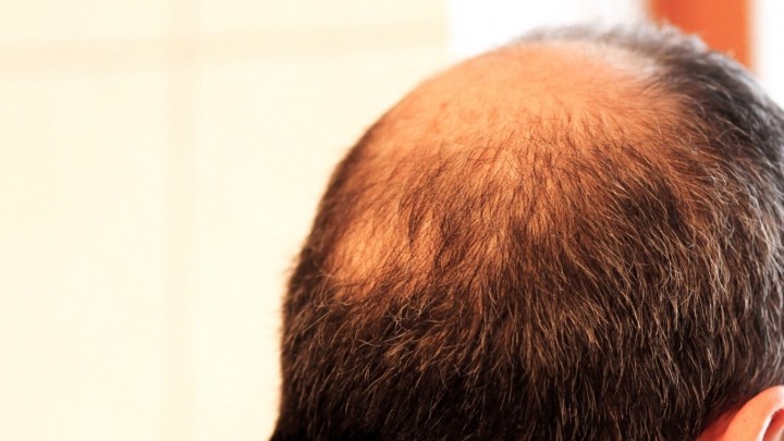 Tipp Fur Mehr Haare Gegen Haarausfall Frag Mutti