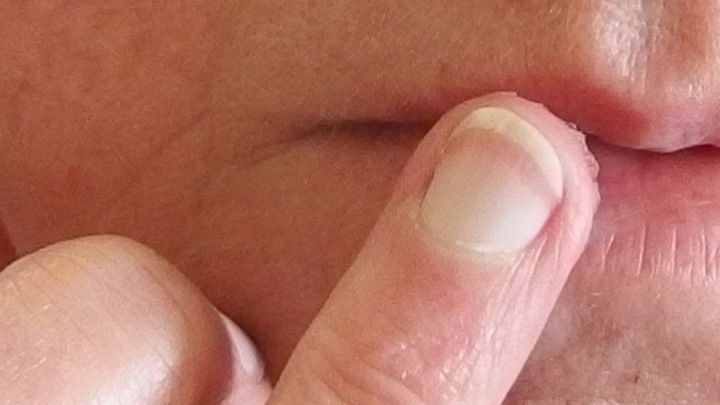 Vaseline Gegen Trockene Lippen Frag Mutti