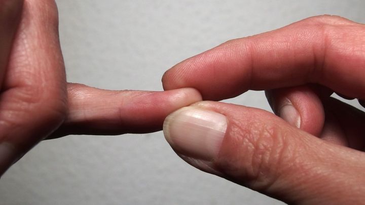 Gegen Schluckauf muss man nicht unbedingt etwas einnehmen. Fingerkuppendrücken hilft.