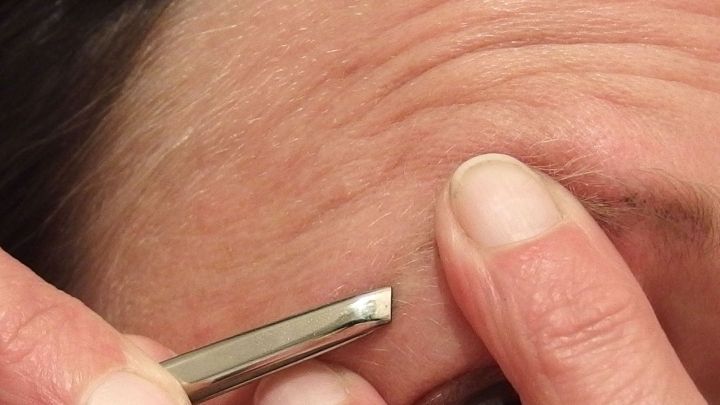 Wenn man mit zwei Fingern der anderen Hand die Haut an der Stelle spannt, an der gerade gezupft wird, dann schmerzt es bei weitem nicht so arg.