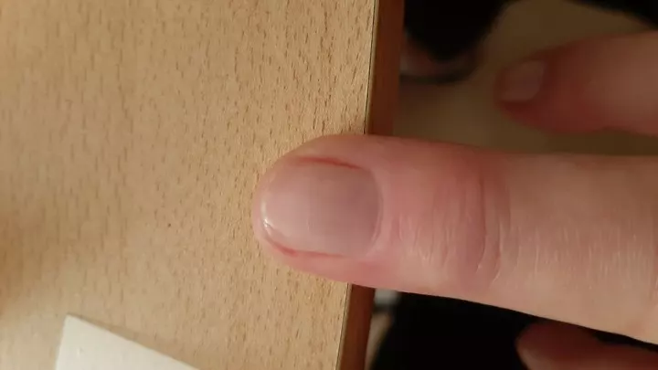 Sehr schwierig wird es dann mit dem Lackieren der Nägel, weil man eigentlich den Pinsel direkt an der kurz geschnittenen Nagelkante nicht sauber abheben kann.
