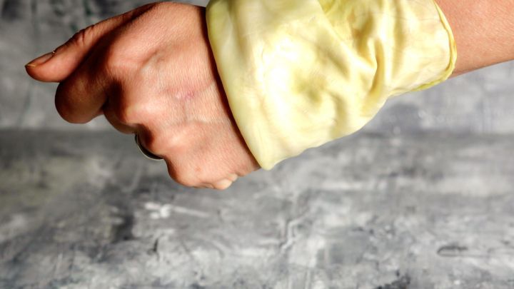 Bei Schmerzen im Knie oder anderen Gelenken und bei geschlossenen Entzündungen, einfach ein Weißkohlblatt mit dem Fingernagel einritzen, so dass der Saft austreten kann und mit einer Wickel fixieren.