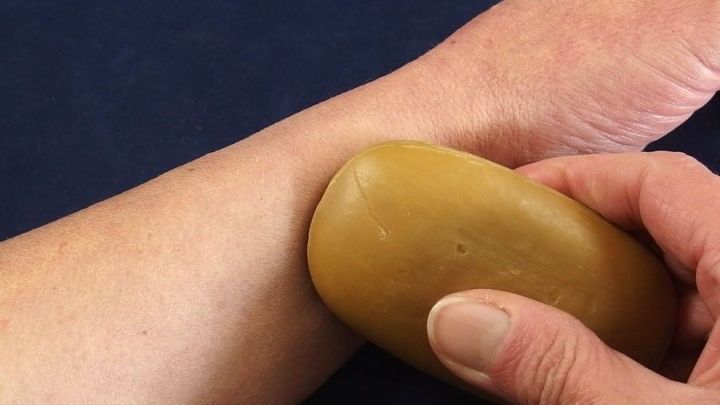 Mückenstich: Seife oder Speichel lindert den Juckreiz.