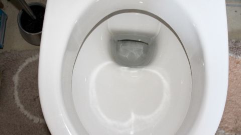 Mit einem Stück Nassschleifpapier der feinsten Körnung lassen sich die Metallschlieren mühelos ohne Schaden beseitigen.