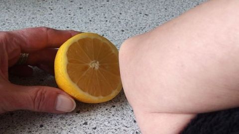 Hornhaut an Ellbogen oder Knie entfernen mit Zitrone.
