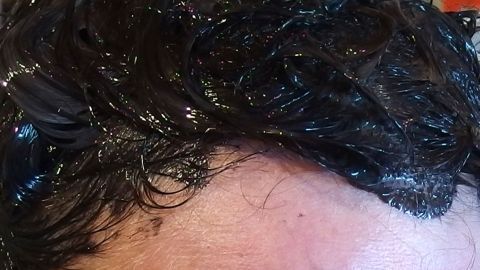 So entfernt man Ränder von Haarfarbe auf der Haut nach dem Haare färben.