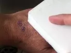Stempel mit Schmutzradierer von der Hand entfernen