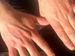 Tipp gegen raue Hände