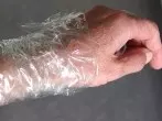 "Verband" aus Frischhaltefolie