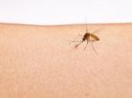 Hilfe gegen Mückenstiche: Bepanthen und <strong>Essig</strong>