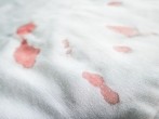 Blutfleck aus weißem Stoffsofa entfernen