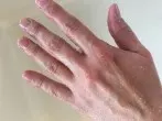Hände Peeling leicht gemacht