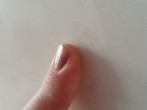 Tipps gegen brüchige Fingernägel