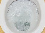 Kalkablagerungen im WC <strong>entfernen</strong>, bis unter den Rand