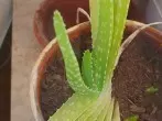 Aloe vera bei Verbrennungen