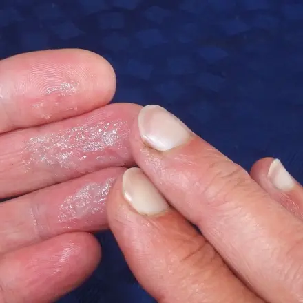 Melkfett statt teurer Cremes