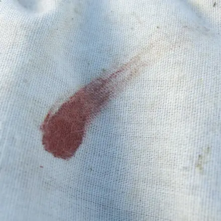 Alte, hartnäckige Blutflecken (außer Fett) mit Backhefe entfernen