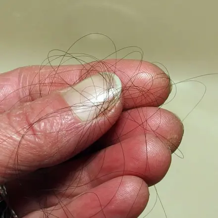 Abfluss verstopft? Ursache Haare?