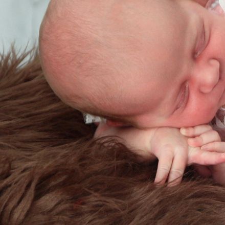 Milchschorf bei Babys