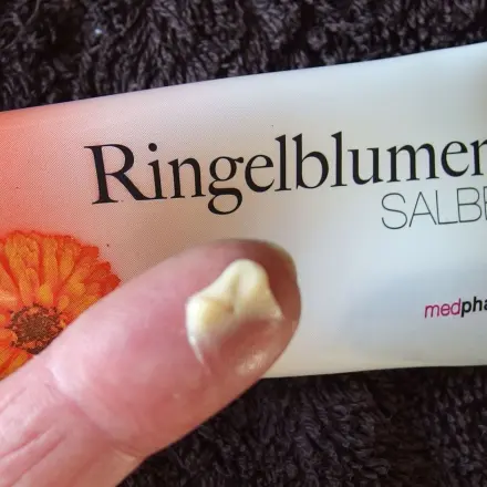 Ringelblumencreme gegen rote entzündete Nase