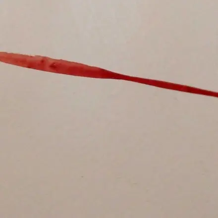 Blutflecken von Oberfächen mit Fensterreiniger entfernen