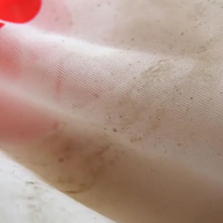 Stockflecken? Buttermilch hilft