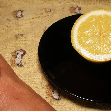 So werden Altersflecken blasser