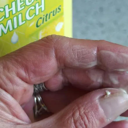 Scheuermilch gegen Nikotinfinger