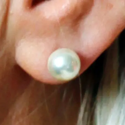 Keine dicken Ohrläppchen durch Ohrringe mehr