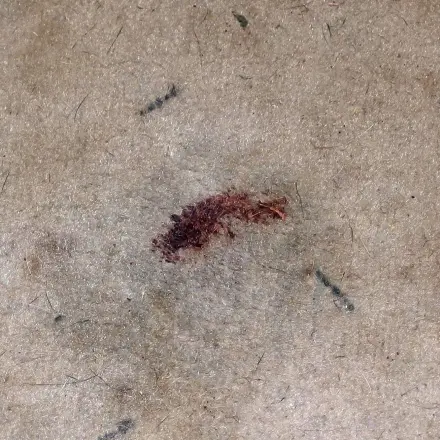 Blutflecken auf dem Teppich?