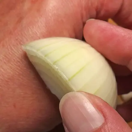 Hilfe bei Insektenstichen