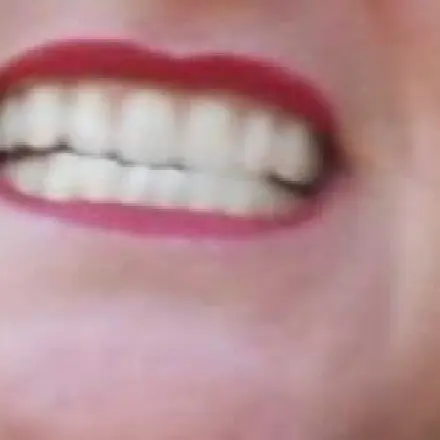 Zahntechniker und Dentallabor selbst aussuchen