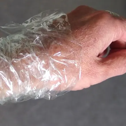 "Verband" aus Frischhaltefolie