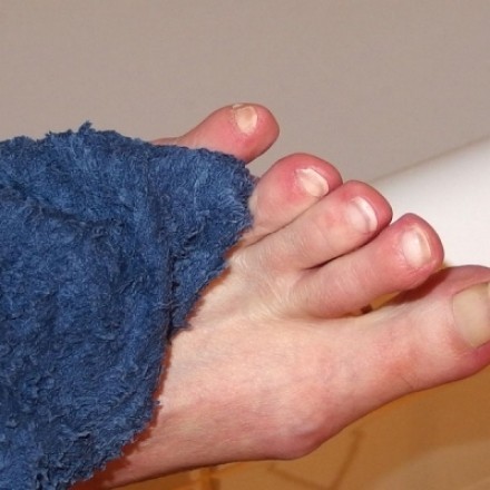 Fußpilz vorbeugen: regelmäßiges Reinigen der Füße & mehr