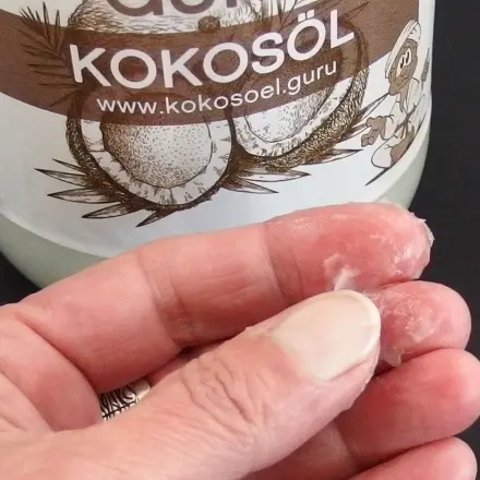 Kokosölbad gegen trockene Haut