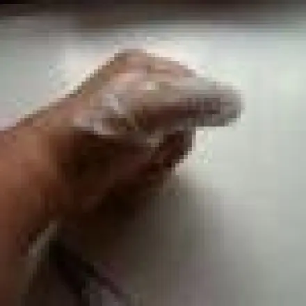 Schneller Verband für den Finger