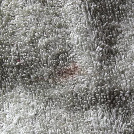 Kein Weichspüler bei Fleckentfernung