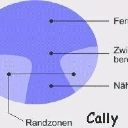 Mit Nackenschmerzen zum Augenarzt?