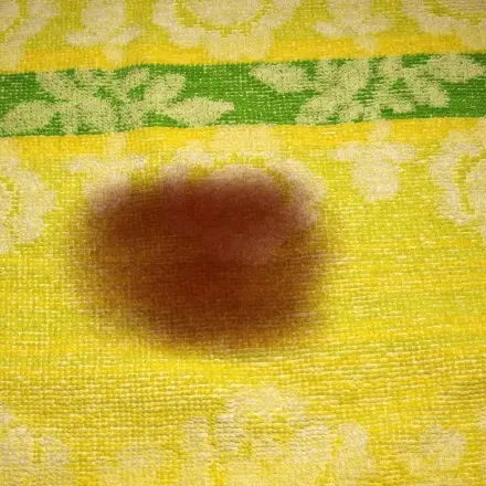 Jod-Flecken entfernen