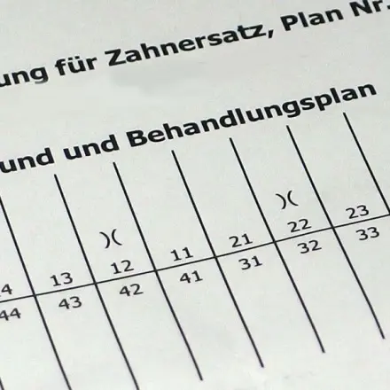 Kostenvoranschlag vom Zahnarzt - Alternativvorschlag einholen