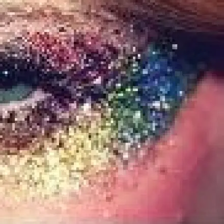 Kostümparty: eindrucksvoller "Lidschatten"