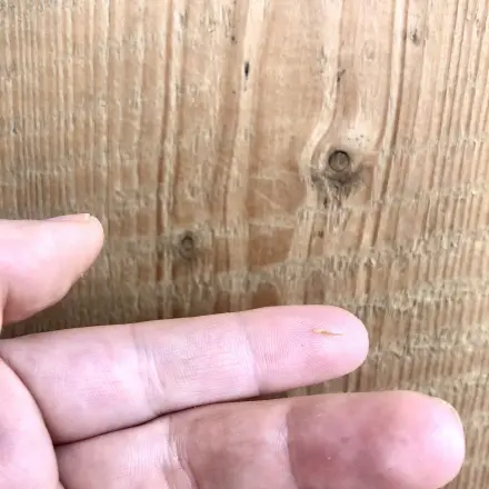 Kleine Splitter aus der Haut entfernen