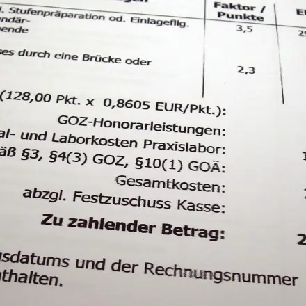 Kosten sparen beim Zahnersatz