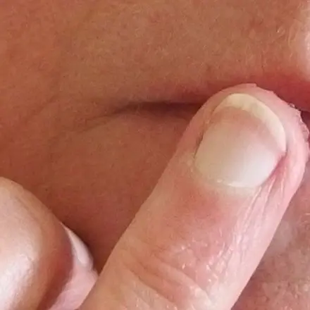 Vaseline gegen trockene Lippen