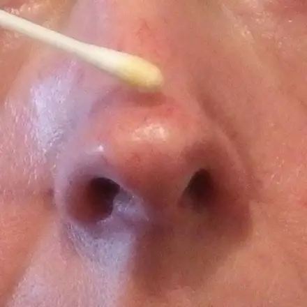 Propolis hilft bei kleinen Entzündungen