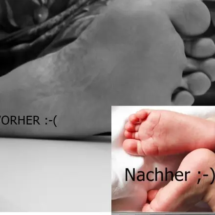 Füße ohne Hornhaut