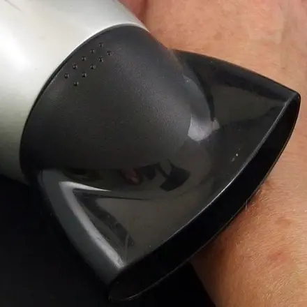 Insektenstich juckt - Föhn gegen Juckreiz