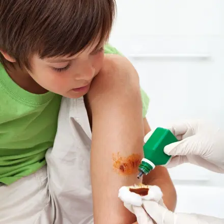 Betaisodona Lösung - Antiseptikum für Haut und Wunden