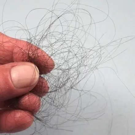 Haarausfall nach Schwangerschaft