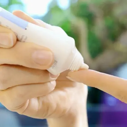 Hirschtalgcreme gegen Herpes und raue Nase